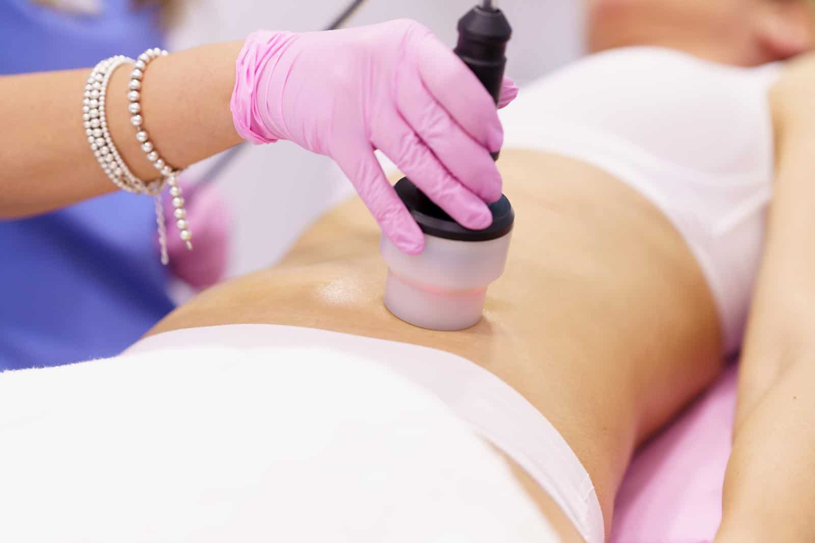 ALPHA - כתבי מנוי MyDoctor 44 40241724 woman receiving anti cellulite treatment with radiofrequency machine in a beauty center